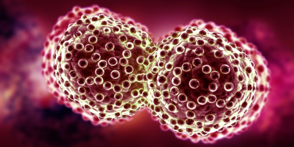 New heat-based approach to cancer treatment can reduce chemotherapy doses New heat-based approach to cancer treatment can reduce chemotherapy doses